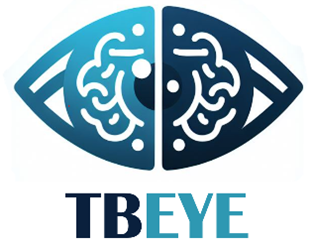 TBEye logo